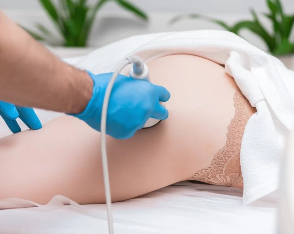 PT_BLOG_Aparelho de ultrassom para estética saiba quais são os benefícios!